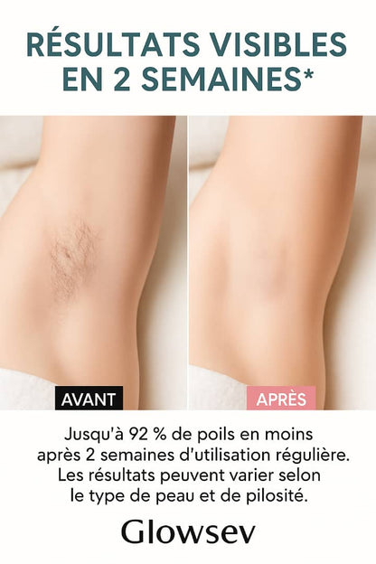 GlowSev – Appareil d’Épilation Laser Premium Compact | Épilation Permanente Technologie 2025